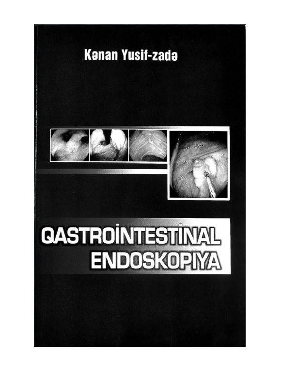 Qastrointestinal Endoskopiya