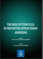 THE ROLE OF STEM CELLS IN PREVENTING INTRAUTERINE ADHESIONS
