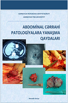  Abdominal cərrahi patologiyalara yanaşma qaydaları