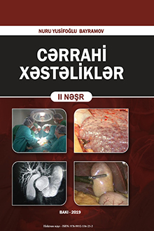 Cərrahi xəstəliklər